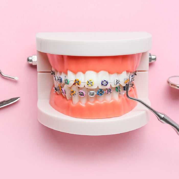 alternatives to braces